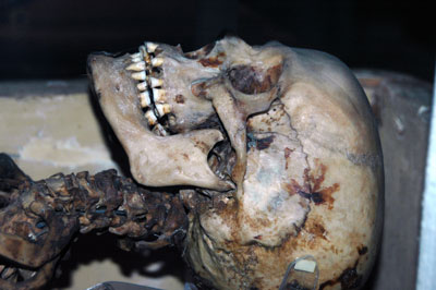 Skull of Nekht-Ankh